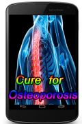 Cure For Osteoporosis