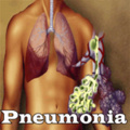 Pneumonia mobile app for free download