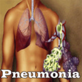 Pneumonia