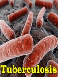 Tuberculosis mobile app for free download