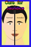 Cure For Jaundice